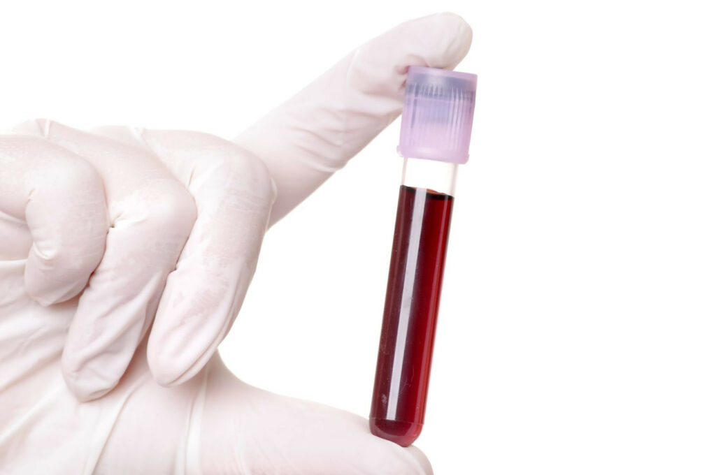 badanie krwi mokotów, wilanów